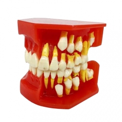 Deciduous Teeth Permanent Tooth Alternate Demonstration Study Teach Model