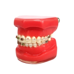 Dental Orthodontic Study Teeth Model With Ceramic & Metal Brackets