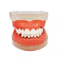 Dental Teeth Model Study Teach Standard Model Gums Removable Teeth